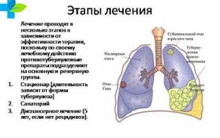 Лечится ли полностью туберкулез