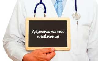 Двухсторонняя пневмония у взрослого человека